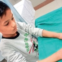 Safdarjung Hospital Doctors Perform ‘Toe-To-Hand’ Surgery On 10-Year-Old Boy