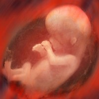 Amniotic Fluid Is A Rich Source Of Stem Cells That Can Now Be Harvested