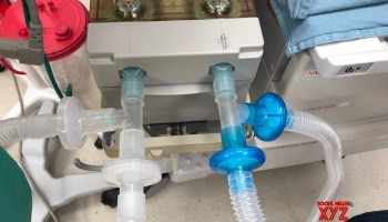 Hyderabad engineers develop low-cost portable ventilator Hyderabad engineers develop low-cost portable ventilator