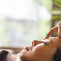 Acupuncture can be safe option to treat migraines