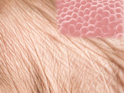 Ageing in human skin cells reversed by 30 years Ageing in human skin cells reversed by 30 years