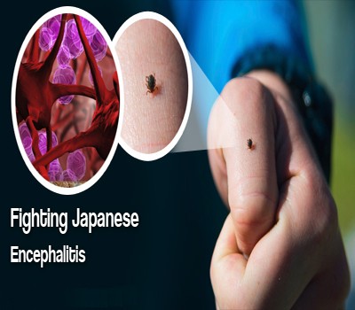 Assam: Japanese Encephalitis claims 63 lives, infects 347 Assam: Japanese Encephalitis claims 63 lives, infects 347