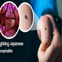 Assam: Japanese Encephalitis claims 63 lives, infects 347