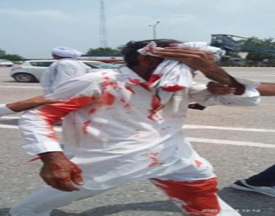 Congress condemns lathicharge on farmers in Karnal Congress condemns lathicharge on farmers in Karnal
