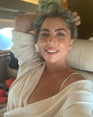 Lady Gaga's dog-walker needs financial help to heal, travel Lady Gaga's dog-walker needs financial help to heal, travel