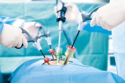 156 renal stones from removed from man at Hyderabad hospital 156 renal stones from removed from man at Hyderabad hospital