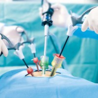 156 renal stones from removed from man at Hyderabad hospital