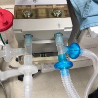 Why Covid patients require prolonged ventilation