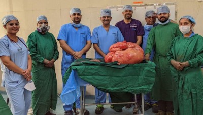 47-kg tumour removed from woman's abdomen 47-kg tumour removed from woman's abdomen