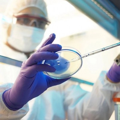 UK Lassa fever death shows rise in global infectious disease risk UK Lassa fever death shows rise in global infectious disease risk