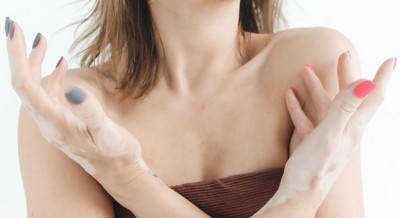 Post Covid skin issues: All your questions answered Post Covid skin issues: All your questions answered