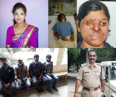 Delayed but not denied: Justice for K'taka acid attack victim Delayed but not denied: Justice for K'taka acid attack victim