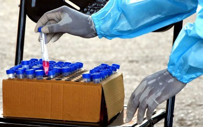 New Covid cases drop below 10K-mark in Karnataka New Covid cases drop below 10K-mark in Karnataka