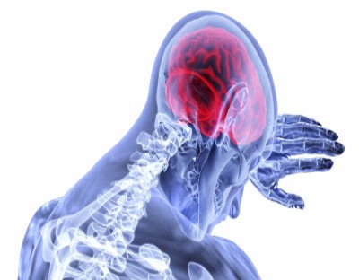 Covid-19 can cause severe inflammation in brain Covid-19 can cause severe inflammation in brain