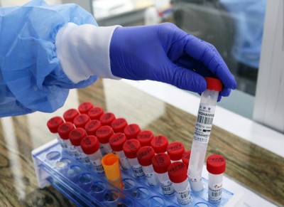 CSIR begins clinical trials of Niclosamide for Covid treatment CSIR begins clinical trials of Niclosamide for Covid treatment