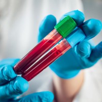 Scientists discover Covid's link to life threatening blood clots