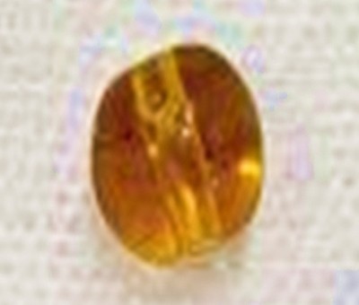 Necklace bead extracted from infant's lungs in Kerala Necklace bead extracted from infant's lungs in Kerala