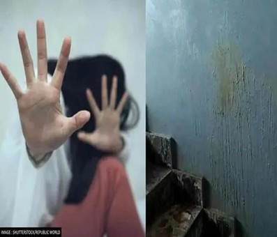 Bengaluru acid attack on married woman, attacker arrested Bengaluru acid attack on married woman, attacker arrested