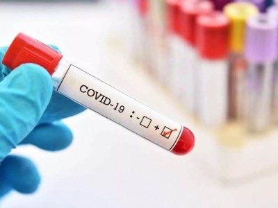 Delhi reports 1,323 fresh Covid cases, 2 deaths