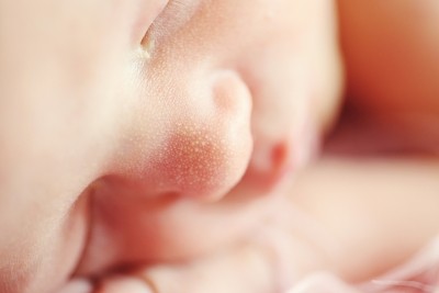 New smartphone app to detect jaundice in babies shows promise New smartphone app to detect jaundice in babies shows promise