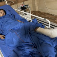 Mamata in hospital with plaster cast on her leg