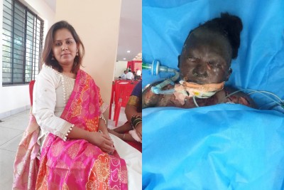 Man torches Dalit partner to death in Bengaluru Man torches Dalit partner to death in Bengaluru