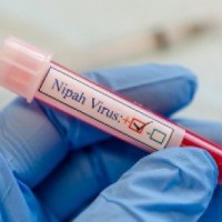 US scientists develop Nipah virus vax that can save lives in just 3 days