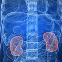 About 85cr across globe suffer from kidney disease: Experts