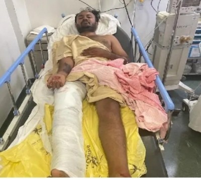 K'taka acid attacker injured in police shootout K'taka acid attacker injured in police shootout