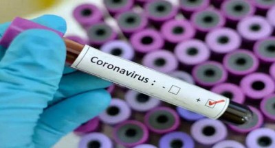 Two South African nationals test Covid positive in B'luru