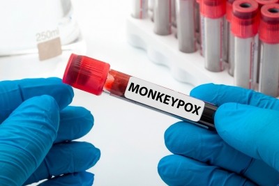 Mozambique reports 1st case of monkeypox
