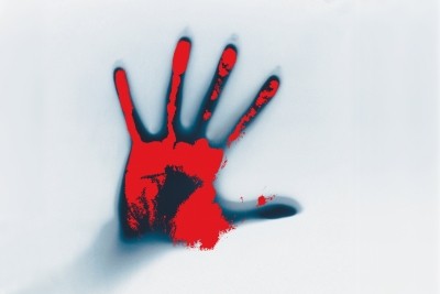 Gujarat: Youth's hand chopped off after he failed to repay Rs 2,500 Gujarat: Youth's hand chopped off after he failed to repay Rs 2,500