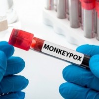 Mozambique reports 1st case of monkeypox