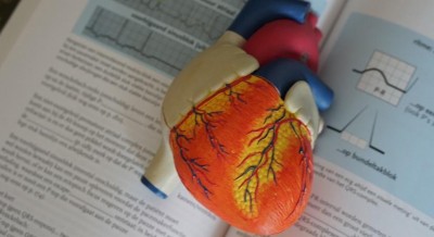 Stiffness of arteries could indicate severe Covid risk: Study Stiffness of arteries could indicate severe Covid risk: Study