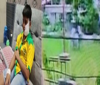 Ghaziabad Shocker: Pitbull bites 10-yr-old boy, child gets 150 stitches Ghaziabad Shocker: Pitbull bites 10-yr-old boy, child gets 150 stitches