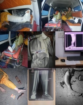 Delhi Police van rams into scooty, injures two women Delhi Police van rams into scooty, injures two women