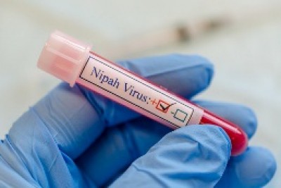 TN's strict monitoring of passengers from Kerala for Nipah virus TN's strict monitoring of passengers from Kerala for Nipah virus