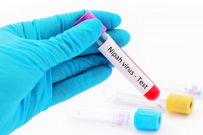 High alert in K'taka dists bordering Kerala over Nipah scare High alert in K'taka dists bordering Kerala over Nipah scare