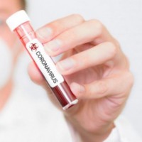 Back from UK 8 test Covid positive for Covid, 1 missing in UP