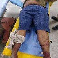 3 criminals injured in 2 encounters in Delhi