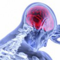 New image analysis method may improve schizophrenia treatment