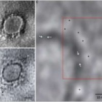 First images of Covid-19 virus in India released
