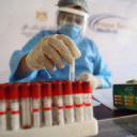 Pharmacies can't sell corona test kits to individuals: Goa advisory