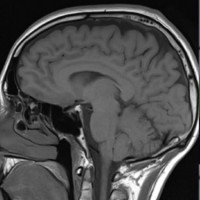 Spine surgeons' body to spread injury prevention awareness