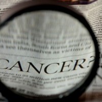 AI-based technique may detect prostate cancer from urine