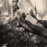 Excessive hand hygiene practices causing skin complications: Dermatologists