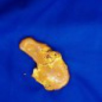 Gold paste seized from passenger at Chennai airport