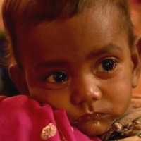A report reveals most of deaths among children due to malnutrition in Telangana