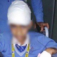 Stones Pelted at School Bus in J&K's Shopian; Two Injured, One Student Critical