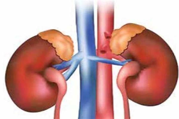 गुर्दे के मरीजों के लिए 'मेडिकल न्यूट्रीशियन थैरेपी' -रोगियों के लिए अच्छी खबर गुर्दे के मरीजों के लिए 'मेडिकल न्यूट्रीशियन थैरेपी' -रोगियों के लिए अच्छी खबर